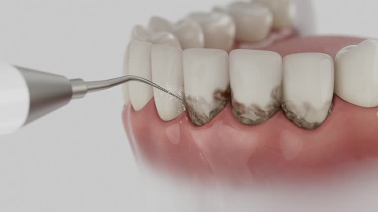 Trusted Dental Crowns And Bridges service in Hogansville, GA - Dentist Open Now
